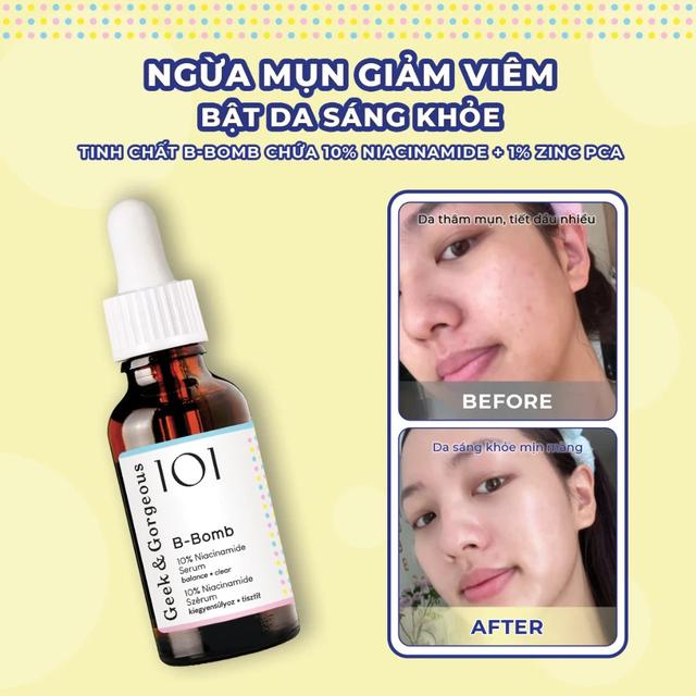 Da đẹp kh&ocirc;ng đến từ việc b&ocirc;i serum hay đắp mặt nạ: 7 nguy&ecirc;n tắc t&ocirc;i theo đuổi suốt 2 năm - Ảnh 7.