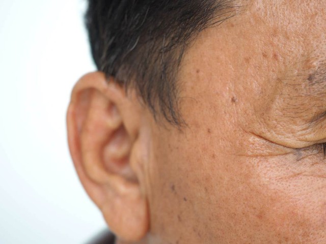 Xu hướng thẩm mỹ nam 2026: Đàn ông không ngại làm đẹp , chỉ cần tươi trẻ và tự nhiên - Ảnh 2. Xu hướng thẩm mỹ nam 2026: Đàn ông không ngại làm đẹp , chỉ cần tươi trẻ và tự nhiên - Ảnh 2.