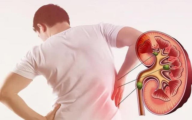 "Cầm dao mổ rồi mới thấy, nhiều quả thận ra đi mãi oan uổng chỉ vì thiếu hiểu biết": 30 cảnh báo từ bác sĩ phòng mổ, ai cũng phải đọc - Ảnh 1.