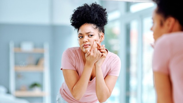 Bác sĩ da liễu chia sẻ những thói quen hằng ngày dễ làm mụn nổi nhiều hơn và cách để da sạch mụn, càng gần Tết chị em càng phải biết - Ảnh 1.