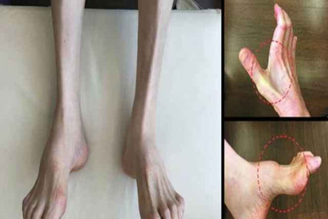 Gia tộc Samsung: Có tất cả nhưng vẫn bất lực trước căn bệnh di truyền đeo bám nhiều đời - Ảnh 4.