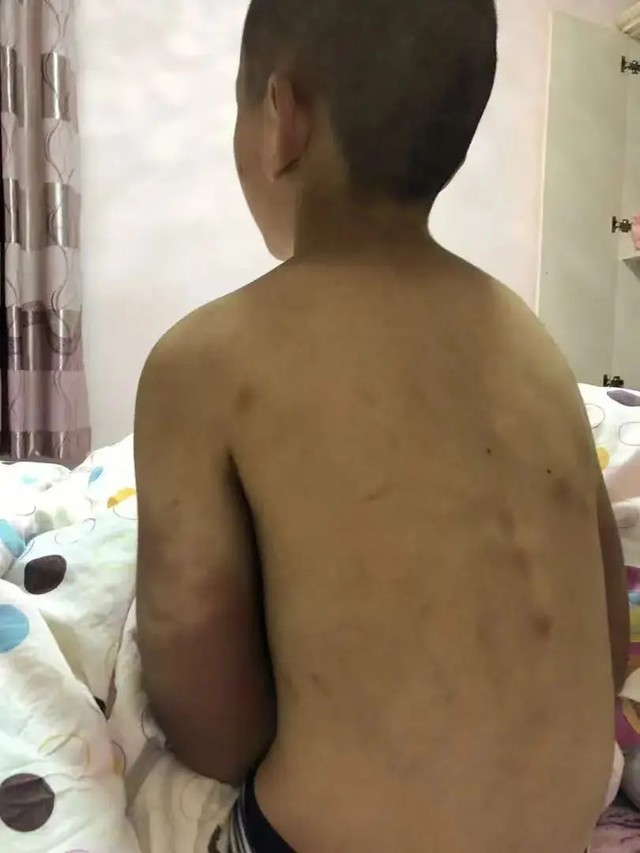 Bi kịch của cậu bé 14 tuổi phải mặc tã - Ảnh 4.