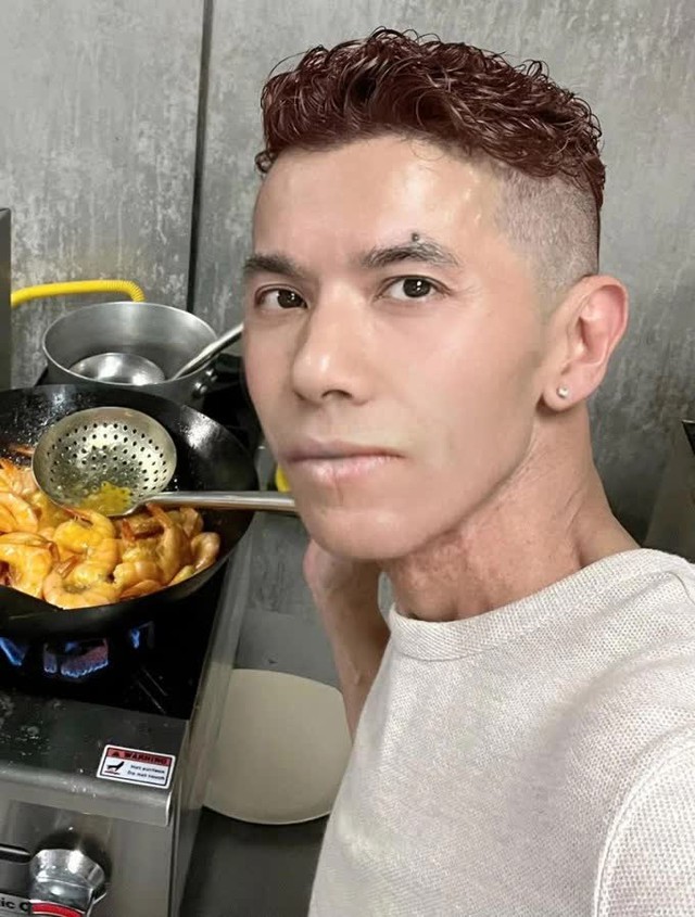 Chi ph&iacute; điều trị bệnh của Kasim Ho&agrave;ng Vũ b&ecirc;n Mỹ 