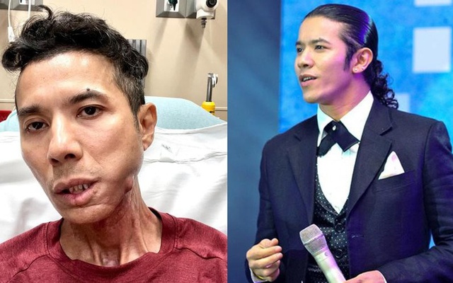 Kasim Ho&agrave;ng Vũ bị bệnh g&igrave; trước khi qua đời? - Ảnh 2.