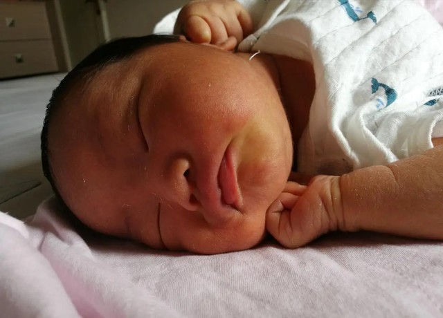 Trẻ sơ sinh có 3 đặc điểm “càng xấu” lại càng chứng tỏ em bé phát triển tốt trong bụng mẹ - Ảnh 3.