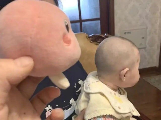 Từng bị ép “nằm ngủ thành đầu bẹt”, lớn lên quyết không lặp lại với con: Bác sĩ chỉ ra cách giúp bé có đầu tròn đúng chuẩn - Ảnh 1.