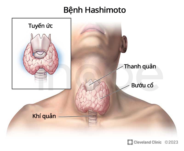 Nữ diễn vi&ecirc;n 36 tuổi tiết lộ 