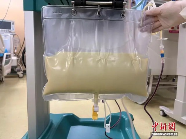 Sản phụ mang song thai gặp tình trạng “máu như sữa” nguy kịch - Ảnh 1.