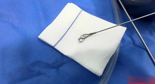 Bé 8 tháng tuổi bị “mắc dị vật ở họng” do nuốt phải giấy bạc: Nguy cơ tử vong cao mà nhiều phụ huynh dễ chủ quan - Ảnh 1.