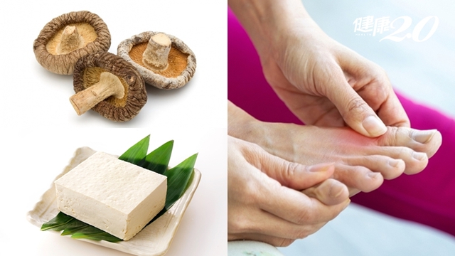 Chế độ ăn cho người bệnh Gout: B&aacute;c sĩ khuy&ecirc;n d&ugrave;ng 4 