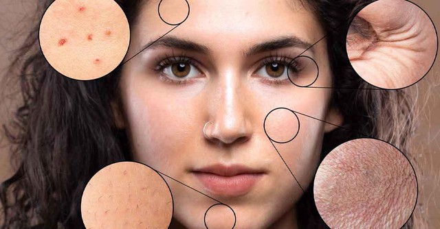 Di căn nhanh, tỉ lệ tử vong cao! C&ocirc; g&aacute;i 25 tuổi qua đời chỉ 5 th&aacute;ng sau khi chẩn đo&aacute;n ung thư, b&aacute;c sĩ đưa ra lời cảnh b&aacute;o hệ trọng - Ảnh 2.