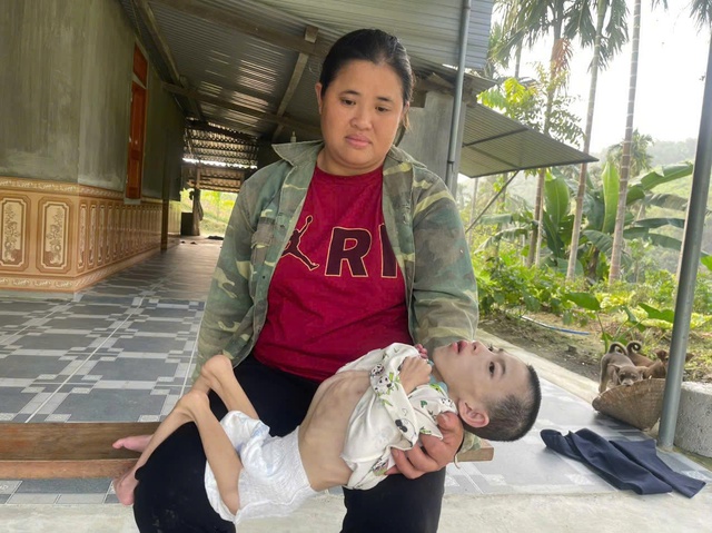 Nỗi đau của người mẹ mang song thai nhưng chỉ c&oacute; một đứa con ch&agrave;o đời mang bệnh bại n&atilde;o - Ảnh 1.