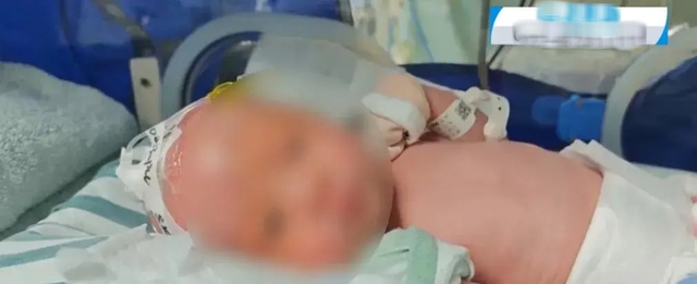 Bảo mẫu ngủ gật khiến trẻ sơ sinh 3 ngày tuổi rơi xuống đất bị xuất huyết não, gia đình yêu cầu bồi thường 700 triệu đồng - Ảnh 1.