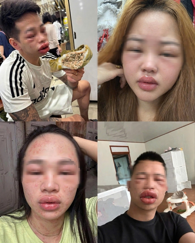 B&aacute;nh trứng kiến v&agrave; gi&aacute; bể Hải Ph&ograve;ng: Cuộc chiến ẩm thực g&acirc;y dị ứng 2026 - Ảnh 4.