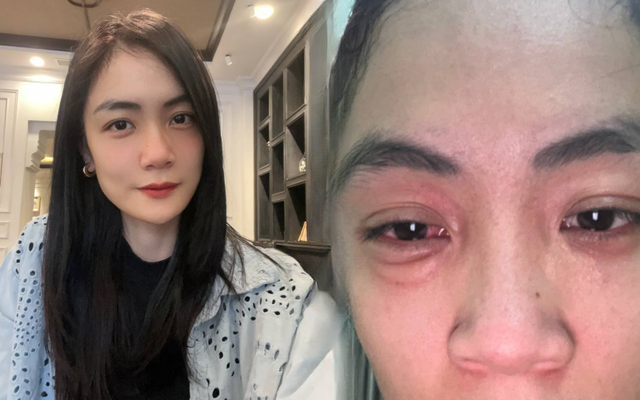 B&aacute;nh trứng kiến v&agrave; gi&aacute; bể Hải Ph&ograve;ng: Cuộc chiến ẩm thực g&acirc;y dị ứng 2026 - Ảnh 6.