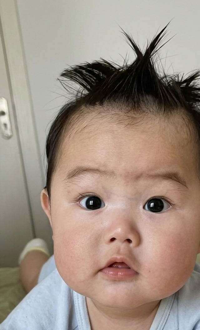 Em bé gây chú ý vì có tới 9 xoáy tóc trên đầu: Liệu có điều gì đặc biệt liên quan đến não bộ của bé? - Ảnh 2.