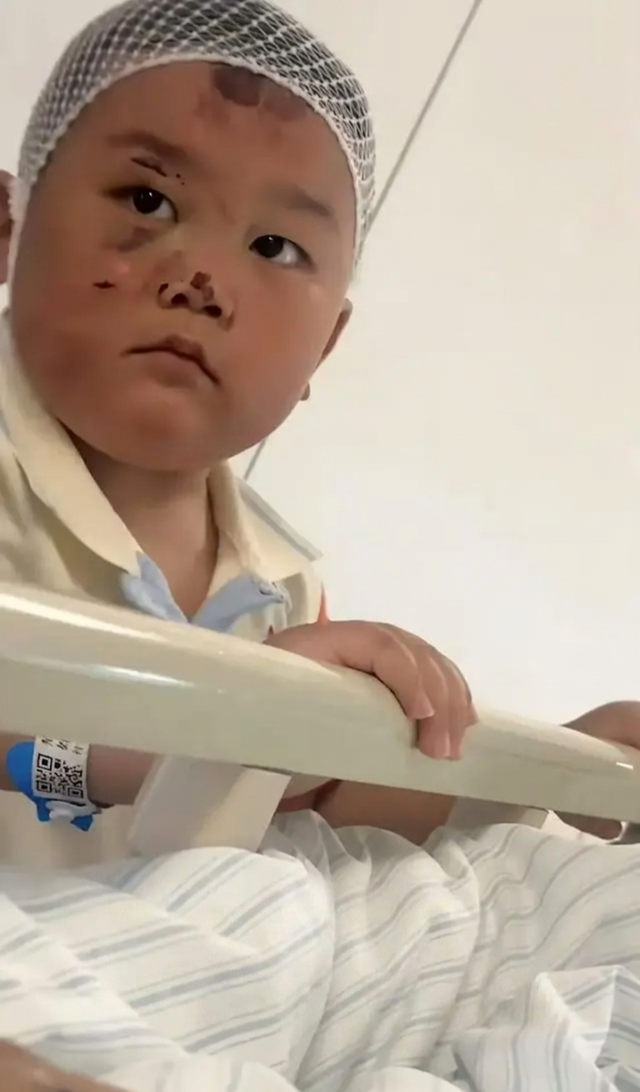 Bé trai 3 tuổi túc trực chăm mẹ sau tai nạn nghiêm trọng: Mặc dù chính bé bị nhiều vết thương đau đớn nhưng vẫn theo sát mẹ không rời - Ảnh 1.