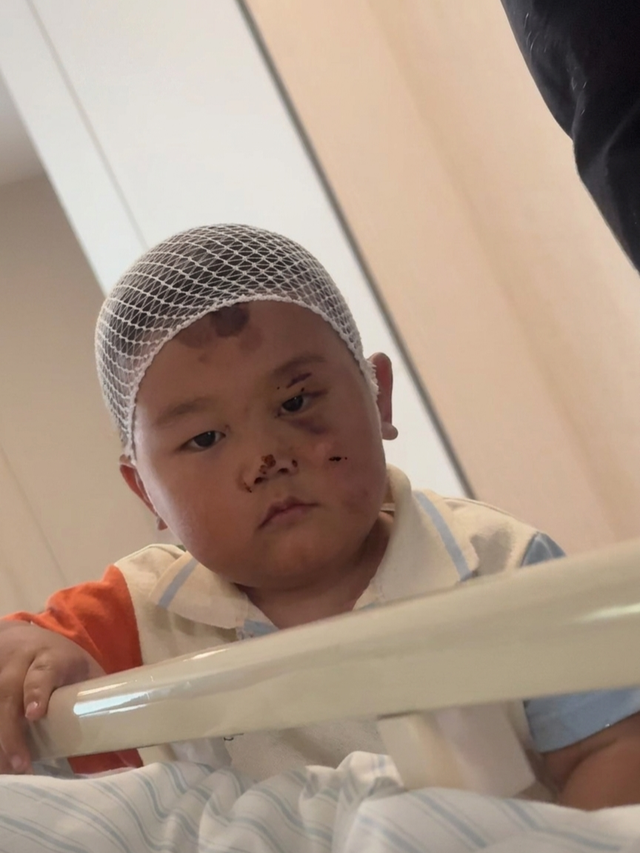 Bé trai 3 tuổi túc trực chăm mẹ sau tai nạn nghiêm trọng: Mặc dù chính bé bị nhiều vết thương đau đớn nhưng vẫn theo sát mẹ không rời - Ảnh 2.