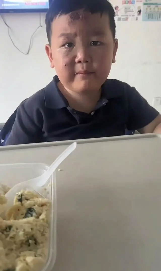 Bé trai 3 tuổi túc trực chăm mẹ sau tai nạn nghiêm trọng: Mặc dù chính bé bị nhiều vết thương đau đớn nhưng vẫn theo sát mẹ không rời - Ảnh 3.