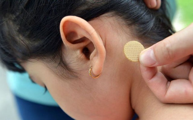 Miếng dán chống say xe: Tiện lợi nhưng ẩn họa cho con trẻ - Ảnh 1.