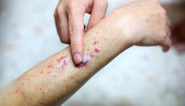 Video lúc nửa đêm của một TikToker 11 triệu người theo dõi khiến nhiều người giật mình: Ung thư máu đến từ thói quen thức khuya, uống trà sữa? - Ảnh 3.