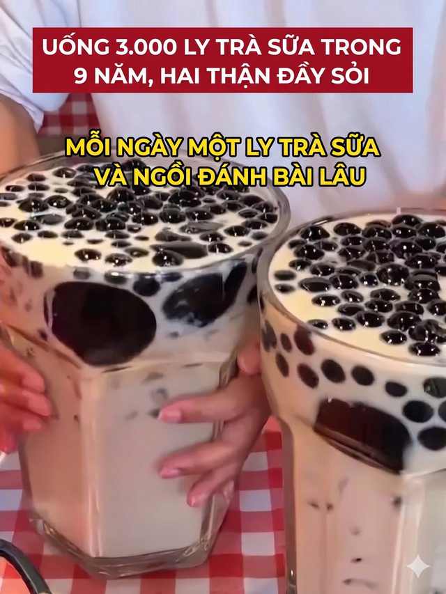 9 năm &ldquo;nghiện&rdquo; tr&agrave; sữa thay nước lọc, uống tới 3.000 cốc: Người phụ nữ biến hai quả thận th&agrave;nh... t&uacute;i đựng sỏi - Ảnh 2.