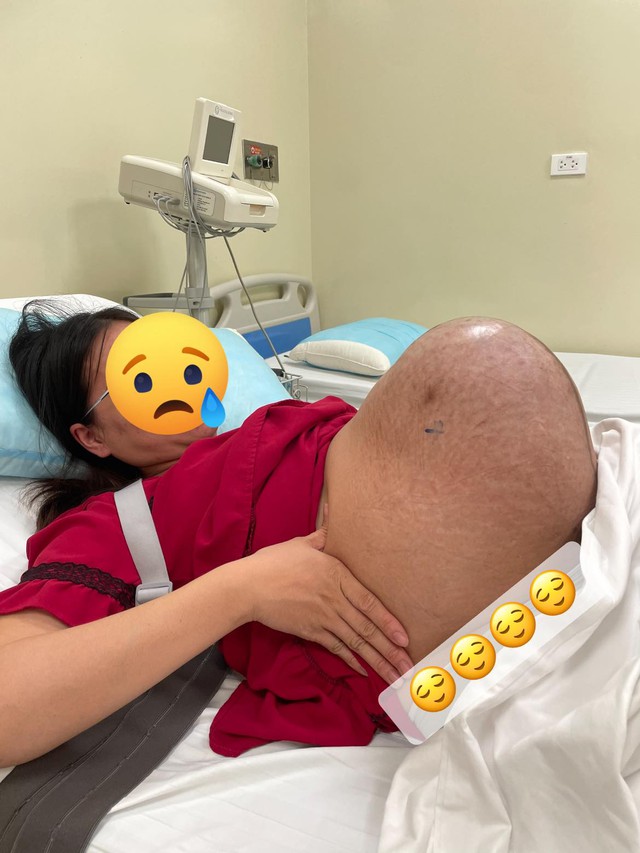 Chiếc bụng của mẹ bầu mang thai đôi khiến ai nhìn cũng xót thay, thế nhưng sinh xong thì cuộc chiến mới chính thức bắt đầu - Ảnh 2.