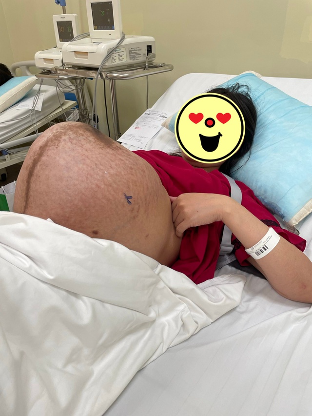 Chiếc bụng của mẹ bầu mang thai đôi khiến ai nhìn cũng xót thay, thế nhưng sinh xong thì cuộc chiến mới chính thức bắt đầu - Ảnh 1.