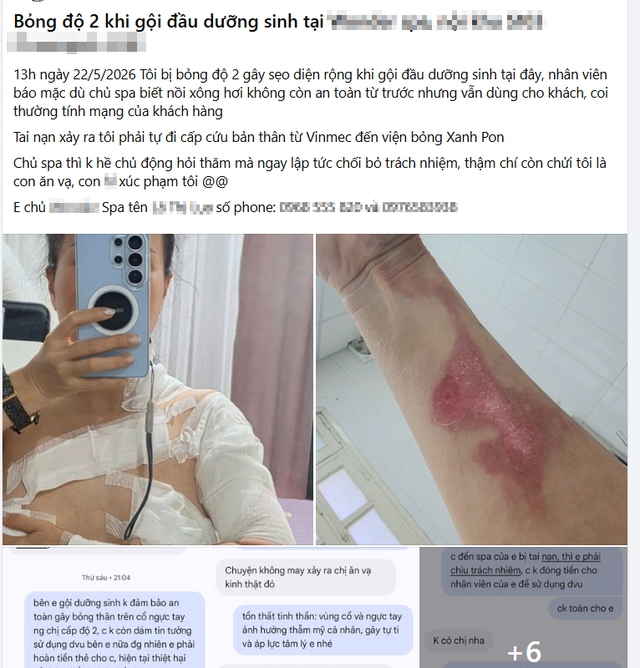 Đi gội đầu dưỡng sinh, cô gái nhận