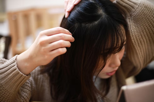 T&oacute;c bạc sớm l&agrave; do thiếu dưỡng chất, bổ sung 7 thực phẩm v&agrave;ng sẽ gi&uacute;p t&oacute;c &ldquo;hồi sinh&rdquo; - Ảnh 4.