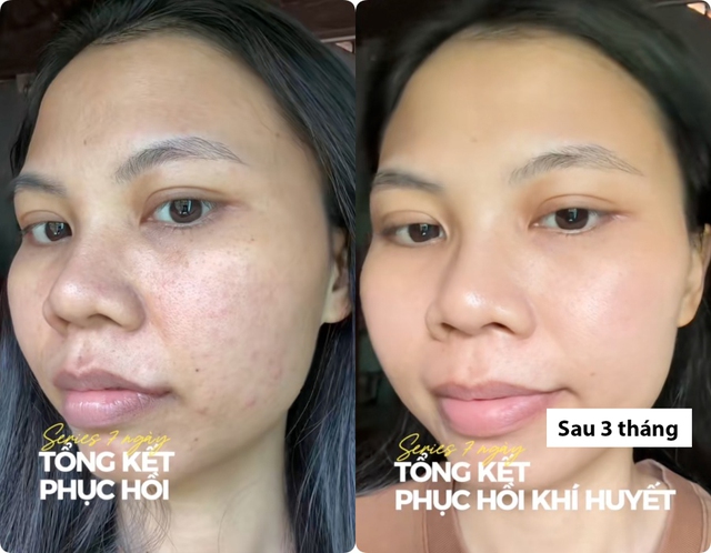 dưỡng kh&iacute; huyết - Ảnh 1.
