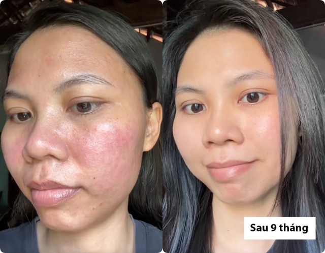 dưỡng kh&iacute; huyết - Ảnh 2.