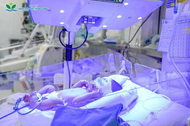 B&eacute; trai sơ sinh mang nh&oacute;m m&aacute;u cực hiếm, kh&ocirc;ng c&oacute; đơn vị m&aacute;u tương th&iacute;ch v&agrave; quyết định đặc biệt của b&aacute;c sĩ để cứu b&eacute; - Ảnh 3.