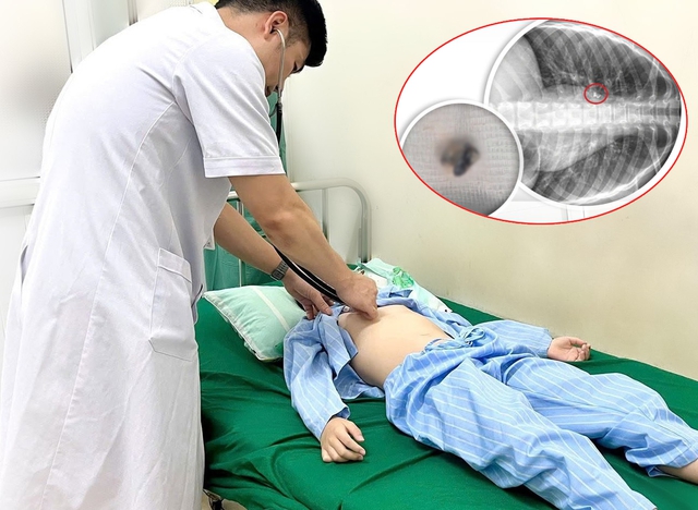 Bé trai 9 tuổi suýt tắc đường thở chỉ vì mẹ tự nhổ răng cho tại nhà - Ảnh 1.
