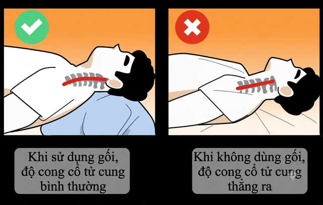 Loại gối nhiều người Việt đang dùng mỗi đêm có thể âm thầm làm tổn thương cổ và mạch máu não: Hãy xem gối của bạn có vậy không - Ảnh 4.