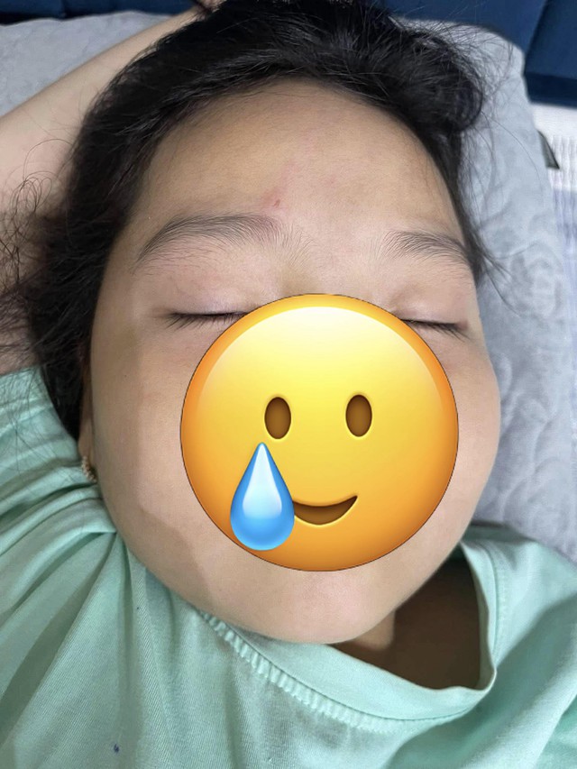 Chỉ 1 phút lơ là mà con gái suýt mù mắt, mẹ bỉm chia sẻ bài học “xương máu” và cách sơ cứu giải nguy trong gang tấc - Ảnh 2.