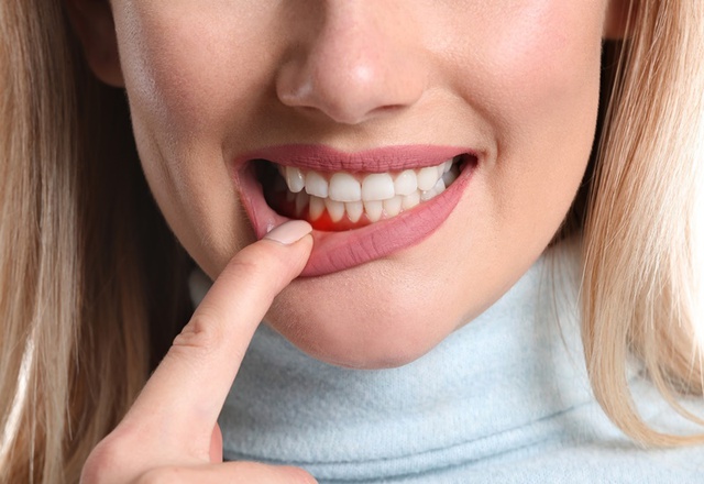 Nghiên cứu trên 160.000 người phát hiện một điều đặc biệt về chuyện đánh răng - Ảnh 4.