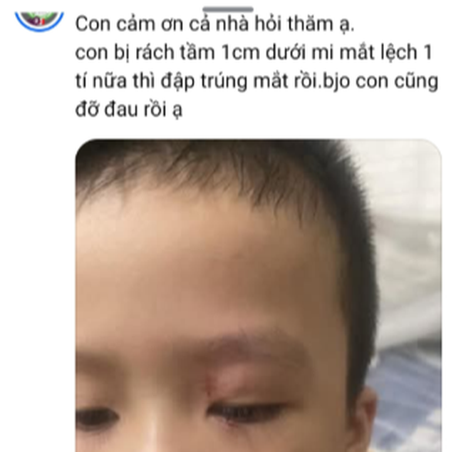 Clip bé trai ngã đập mặt vào góc cạnh sạp hàng: Nhìn vết thương của con mà ai cũng thót tim - Ảnh 1.