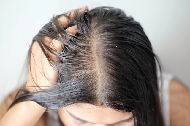 Mới ngoài 30 tuổi, tóc đã bạc nửa đầu, cô gái Hàn Quốc dùng dầu tẩy trang làm sạch tóc, và cái kết bất ngờ - Ảnh 1.