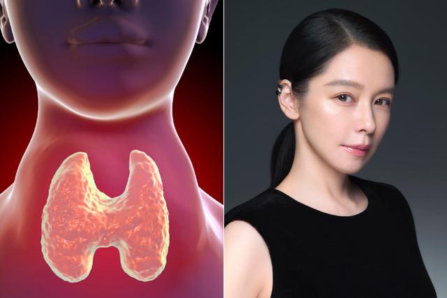 Tuyến gi&aacute;p rất gh&eacute;t bạn l&agrave;m 5 việc n&agrave;y, bạn đang mắc bao nhi&ecirc;u c&aacute;i? - Ảnh 4.