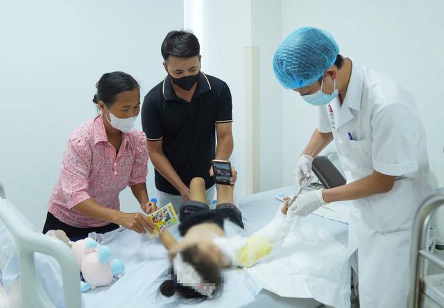 C&aacute;nh tay của b&eacute; g&aacute;i 4 tuổi bị đứt rời sau tai nạn &aacute;o chống nắng cuốn v&agrave;o b&aacute;nh xe m&aacute;y được nối lại th&agrave;nh c&ocirc;ng: BS cảnh b&aacute;o sai lầm của nhiều cha mẹ - Ảnh 3.