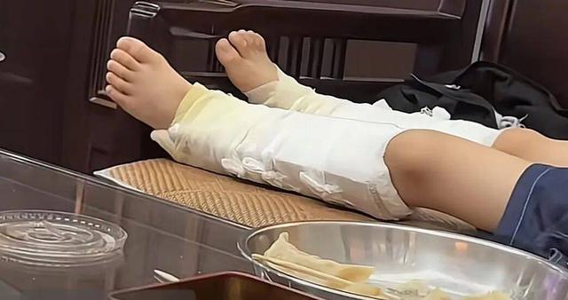 Cậu bé gãy cả hai xương gót chân vì bắt chước siêu nhân nhảy từ trên cao - Ảnh 1.