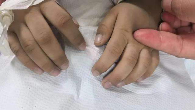 Bé 3 tuổi tím tái, bác sĩ phát hiện ngộ độc nitrit: 6 kiểu đồ ăn thừa cha mẹ nên lưu ý - Ảnh 2.