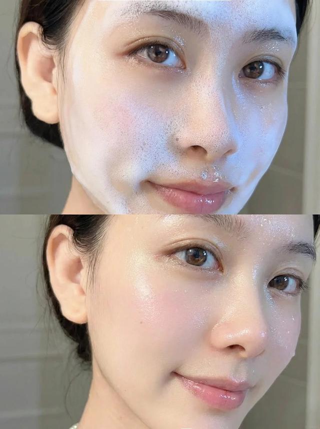 Da càng dưỡng càng yếu có thể do sai lầm này: Cách phục hồi trong 2–3 tuần - Ảnh 3.