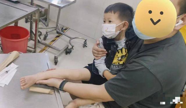 B&eacute; g&aacute;i 1 tuổi bị ch&aacute;o n&oacute;ng đổ v&agrave;o người, c&aacute;ch sơ cứu sai của b&agrave; khiến vết bỏng nghi&ecirc;m trọng hơn - Ảnh 3.
