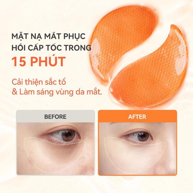 D&ugrave;ng kem mắt m&atilde;i kh&ocirc;ng hiệu quả? C&oacute; thể bạn đang mắc 3 sai lầm phổ biến - Ảnh 7.