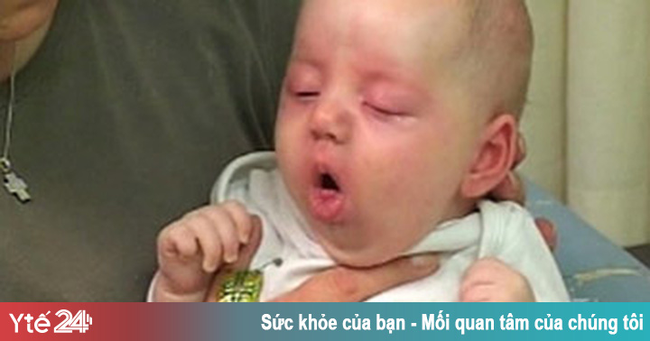 Những dấu hiệu sớm của viêm phổi ở trẻ - Ảnh 1. Những dấu hiệu sớm của viêm phổi ở trẻ - Ảnh 1.