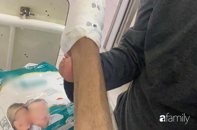 Đau xót con trai cụt tay nghỉ việc vào viện chăm sóc cha phải cắt bỏ 2 bàn chân vì bỏng điện nặng - Ảnh 3. Đau xót con trai cụt tay nghỉ việc vào viện chăm sóc cha phải cắt bỏ 2 bàn chân vì bỏng điện nặng - Ảnh 3.