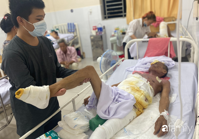 Đau xót con trai cụt tay nghỉ việc vào viện chăm sóc cha phải cắt bỏ 2 bàn chân vì bỏng điện nặng - Ảnh 1. Đau xót con trai cụt tay nghỉ việc vào viện chăm sóc cha phải cắt bỏ 2 bàn chân vì bỏng điện nặng - Ảnh 1.