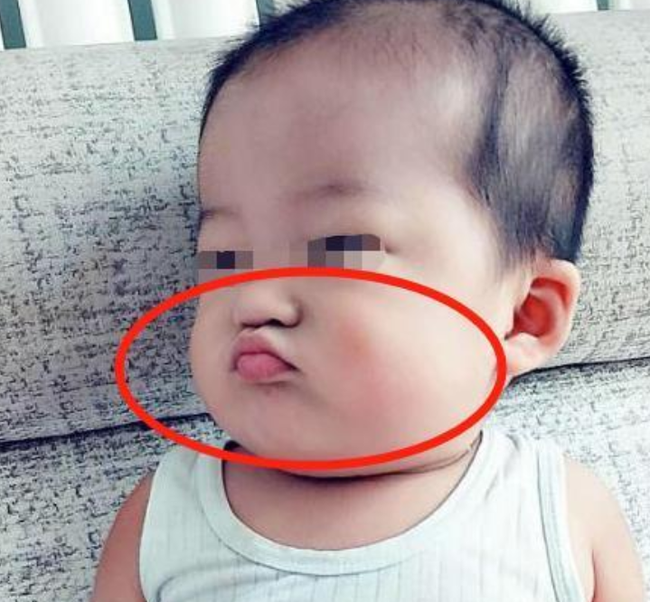 Bé 2 tuổi suốt ngày "chu mỏ", mẹ khen dễ thương nhưng bà nội bế thẳng vào viện khám - Ảnh 1. Bé 2 tuổi suốt ngày "chu mỏ" mẹ khen dễ thương nhưng bà nội bế thẳng vào viện khám - Ảnh 1.